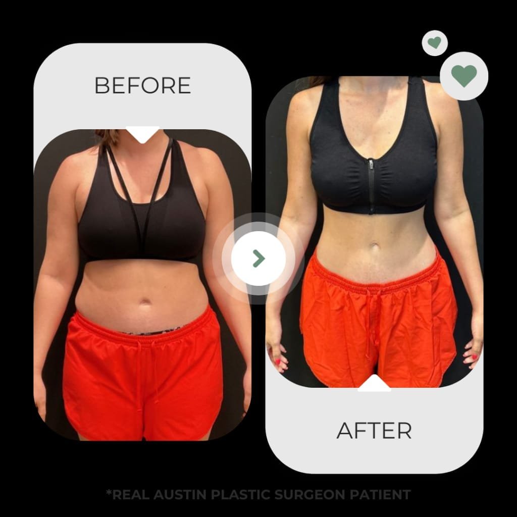 sermorelin before and after